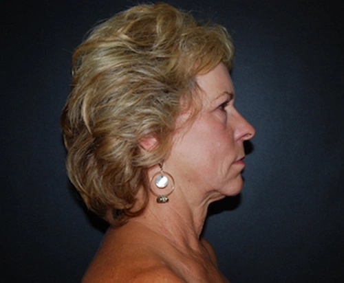 fl1