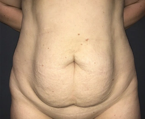 tt3