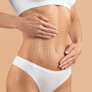 A woman in white underwear touching her toned stomach with a grid overlay, symbolizing body contouring and different types of mommy makeovers.