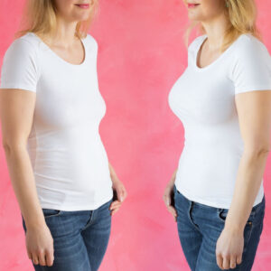 A side-by-side comparison of a woman before and after body contouring surgery, showing a slimmer waist and toned figure, illustrating the transformative results and factors influencing mommy makeover cost.