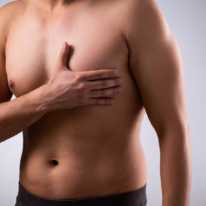 A shirtless man covers his chest with one hand, highlighting visible swelling that may indicate you have gynecomastia.