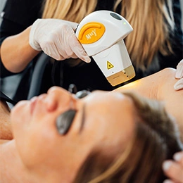 Laser hair removal treatment being performed on woman's face at professional salon - Laser skin treatment in Newport Beach, CA