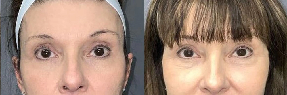 eyes1